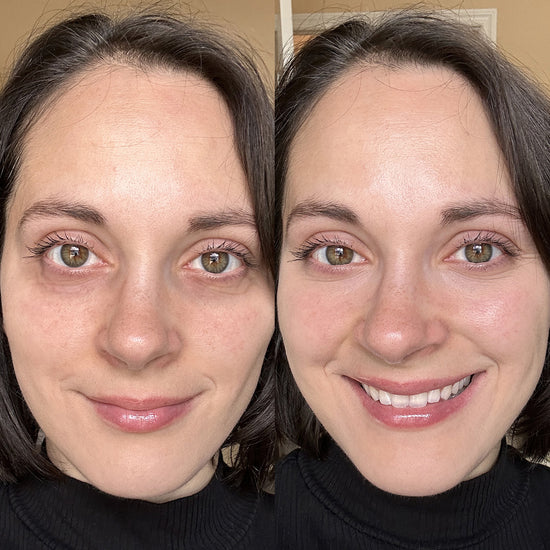 LumiLift™ | Under-Eye Red Light Therapy